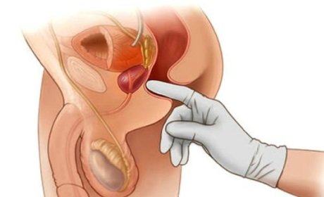 massaggio prostata interno