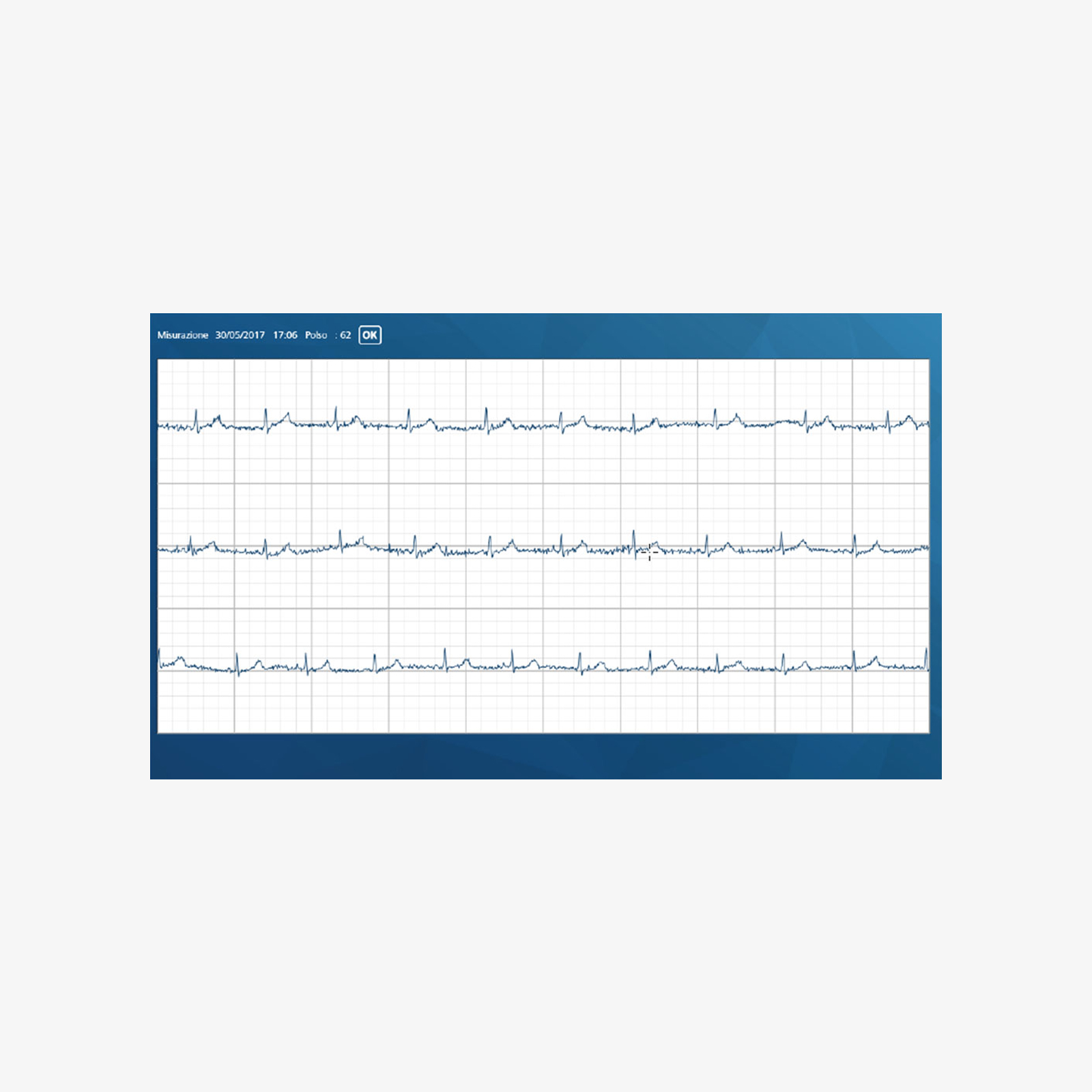 Veroval ECG + misuratore di pressione