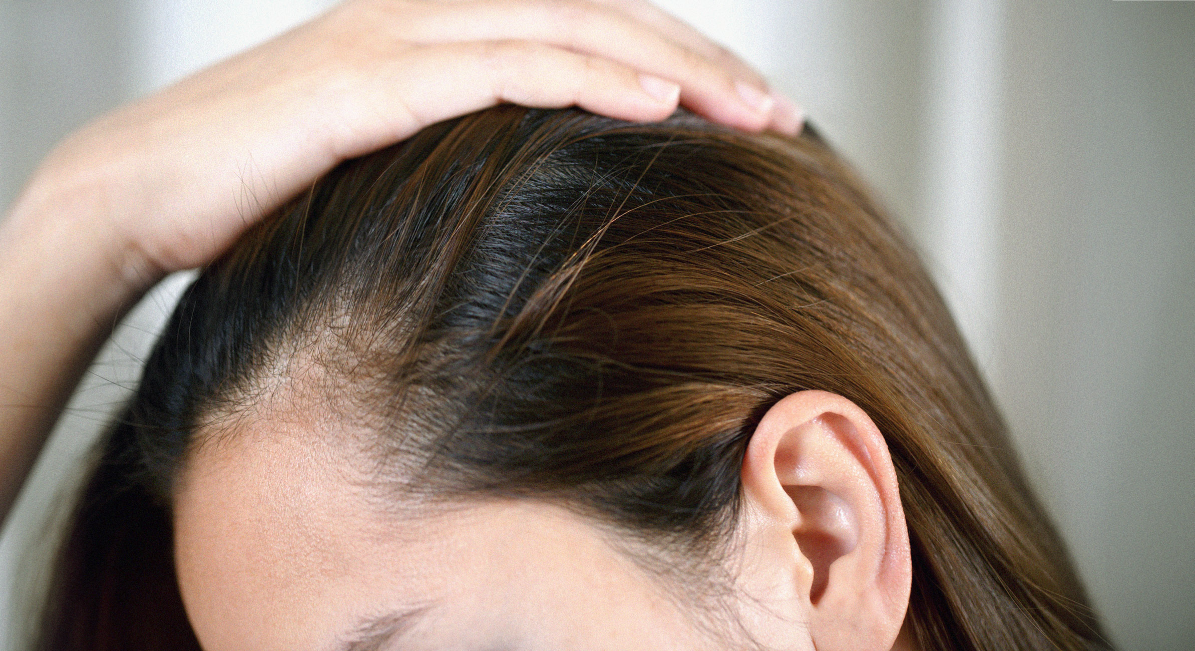 caduta dei capelli donne rimedi